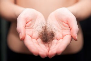 Hair loss telogen effluvium