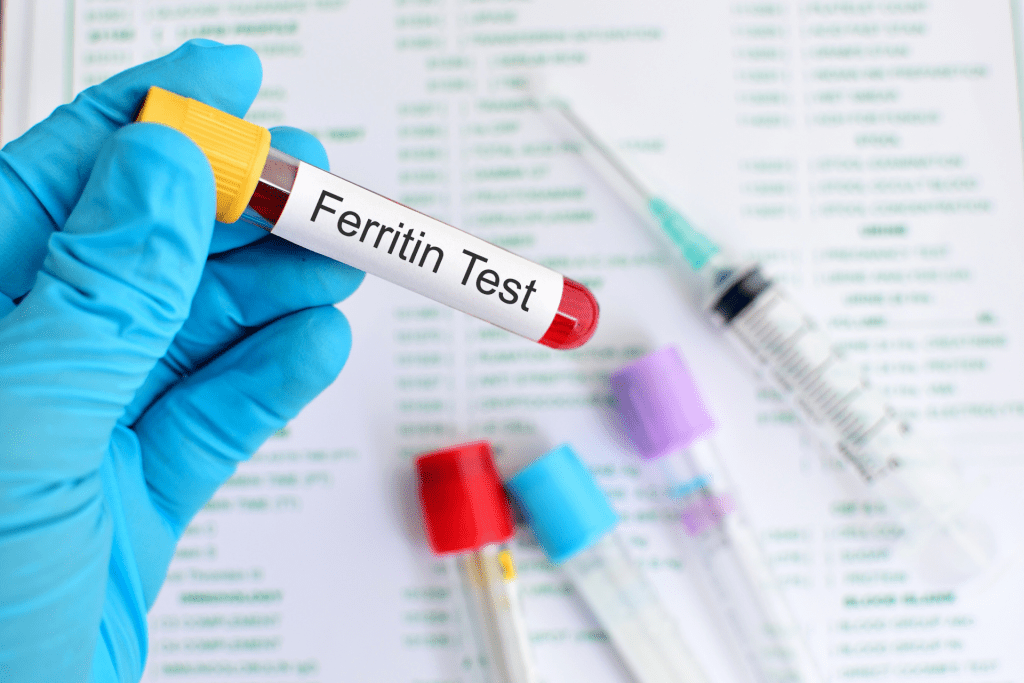 Hair Loss and ferritin deficiency