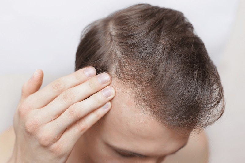 Itchy scalp: Causes and connections to hair loss
