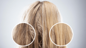 The difference between hair loss and hair breakage