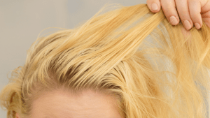 What Causes Greasy Hair?