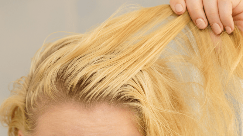 What Causes Greasy Hair?
