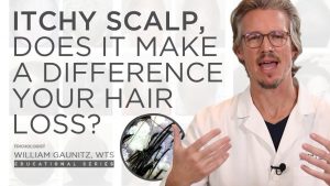 Does an Itchy Scalp Have an Impact on Hair Loss? Dandruff, Seborrheic Dermatitis, and Treatment