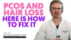 PCOS and hair loss. Why is it happening what can you do about it.