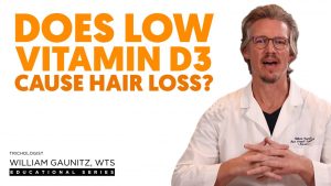 Does Low Vitamin D3 Cause Hair Loss?