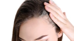 Effective Natural Hair Loss Treatment Tips: Regrow Your Hair Naturally
